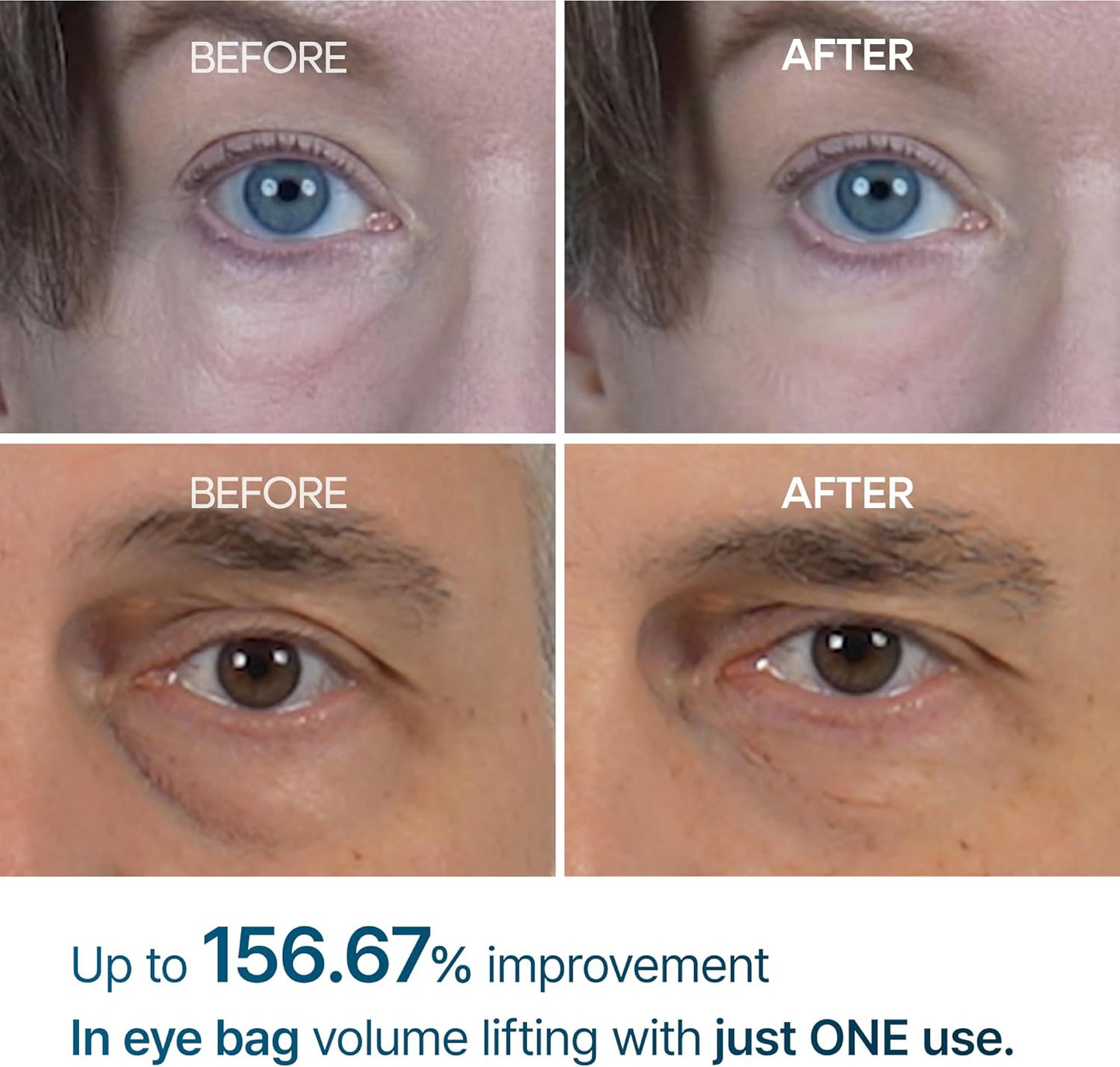 Dr.Melaxin, Eyephalt Anti-Aging Eye Cream (10 ml)