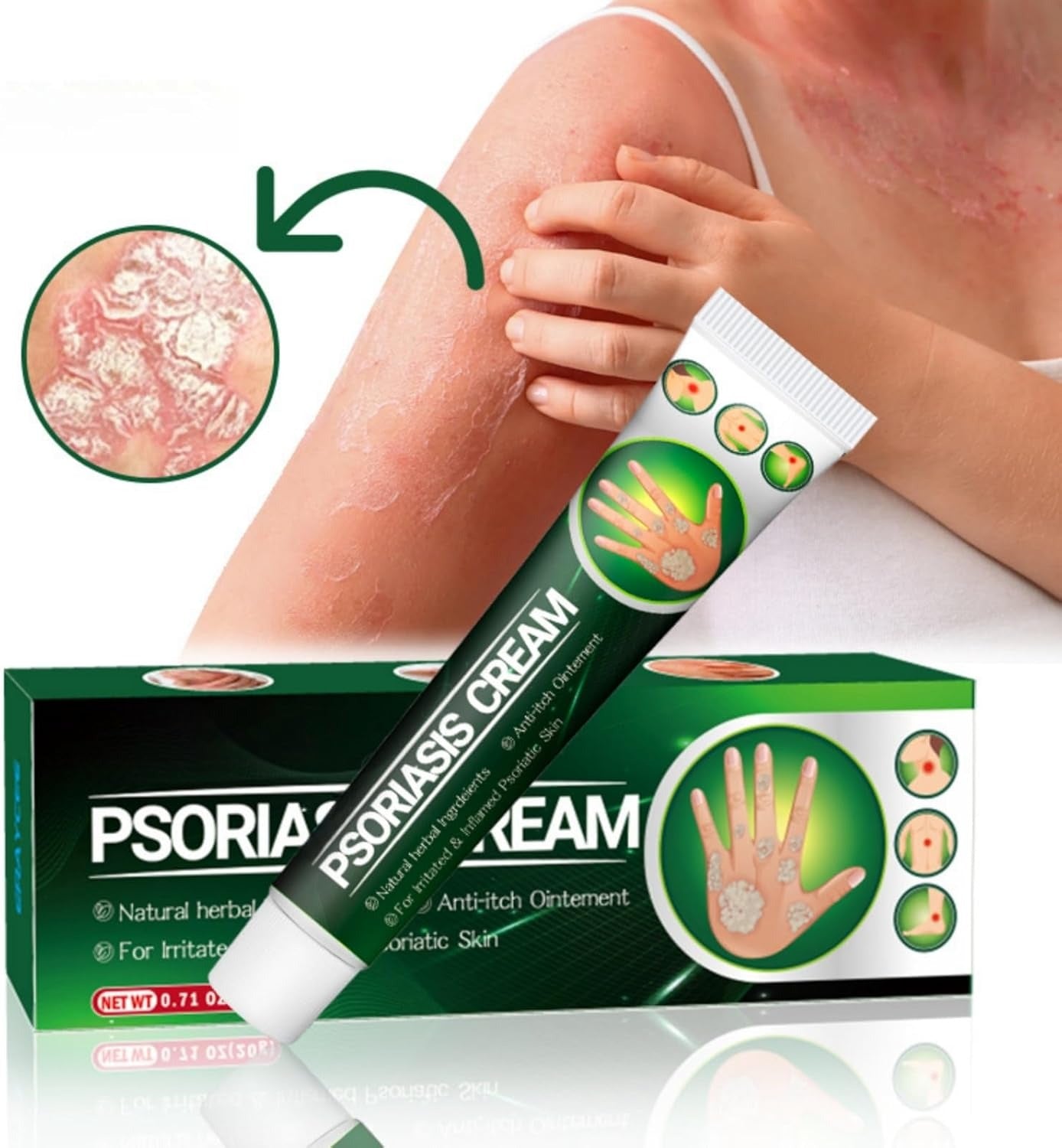 Psoriasis Cream (Original) – 20g (Pack of 2)