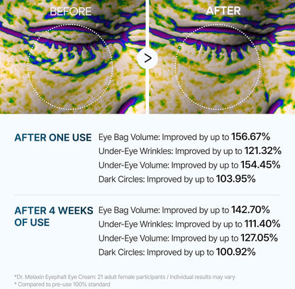 Dr.Melaxin, Eyephalt Anti-Aging Eye Cream (10 ml)